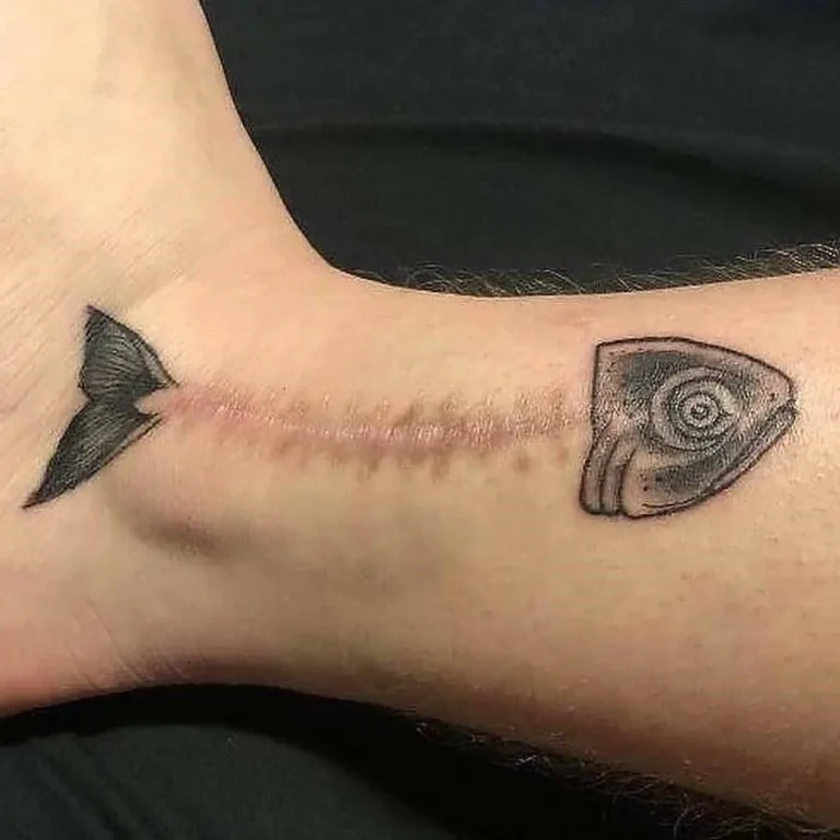Tatouage sur cicatrice représentant un poisson, recouvrement de tatouage
